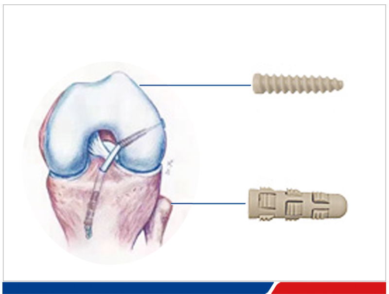peek-star-wheel-11-600x232-1 peek-star-wheel-11-600x232-1