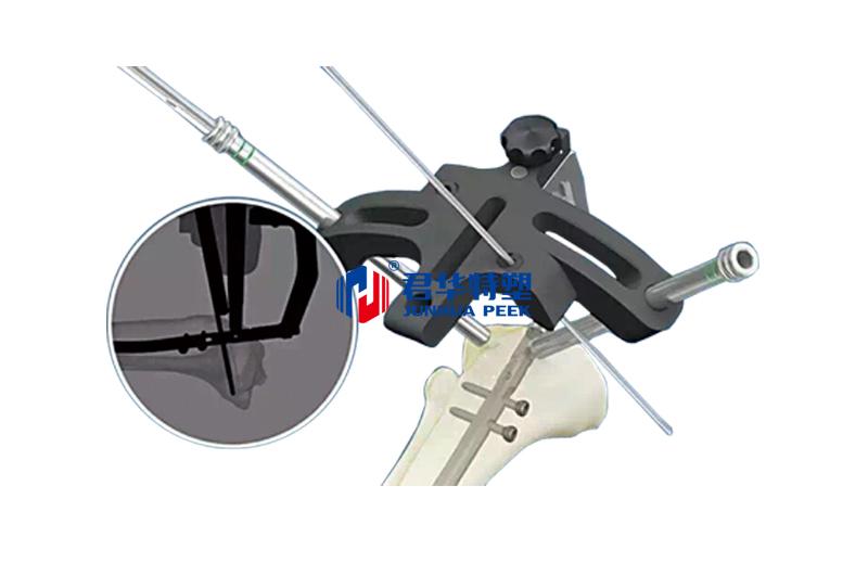 PEEK 로드 홀더, 골수강 내 정 삽입 수술용