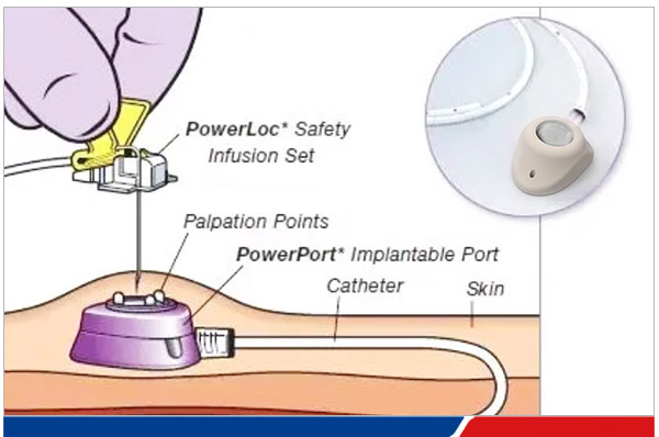 peek-star-wheel-11-600x232-1 peek-star-wheel-11-600x232-1